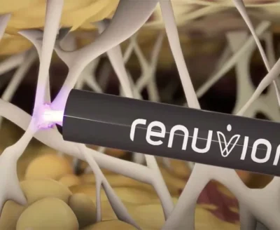 renuvion-j plasma