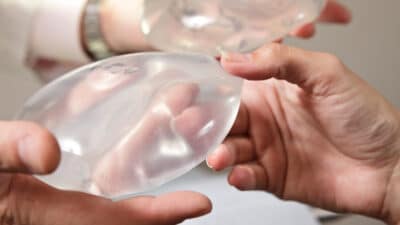 Breast Implant Revision