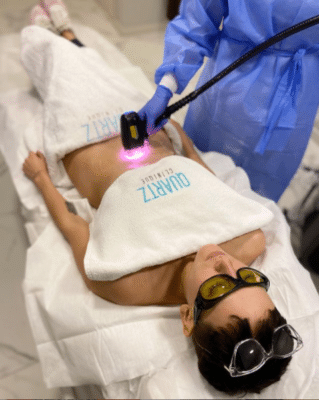 Laser Hair Removal