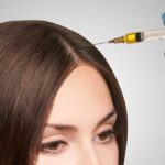 PRP for Hair Loss