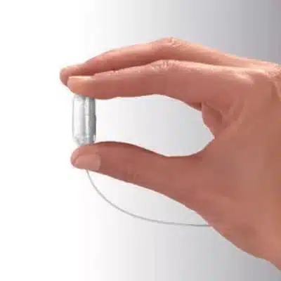 Gastric Balloon