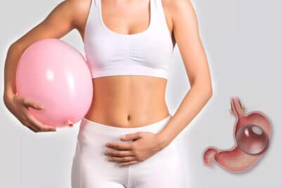 Gastric Balloon