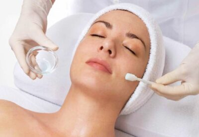 Chemical Peel