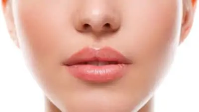 lip lift