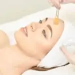 kımyasal peeling