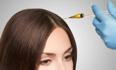 PRP for Hair Loss