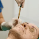 Fat Injection