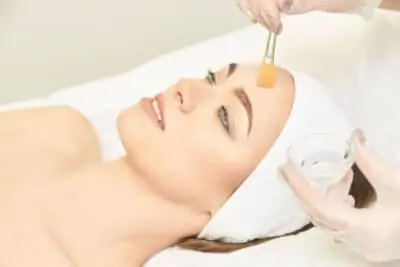 Chemical Peel