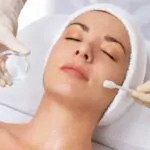 Chemical Peel